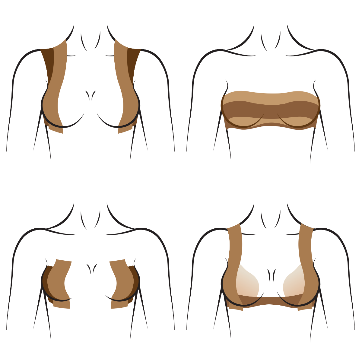 Four diagrams demonstrate different application methods for applying tan adhesive boob tape to provide breast lift and support for various outfit styles.
