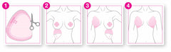 Illustration of a breast augmentation process with stages labeled 1 to 4.